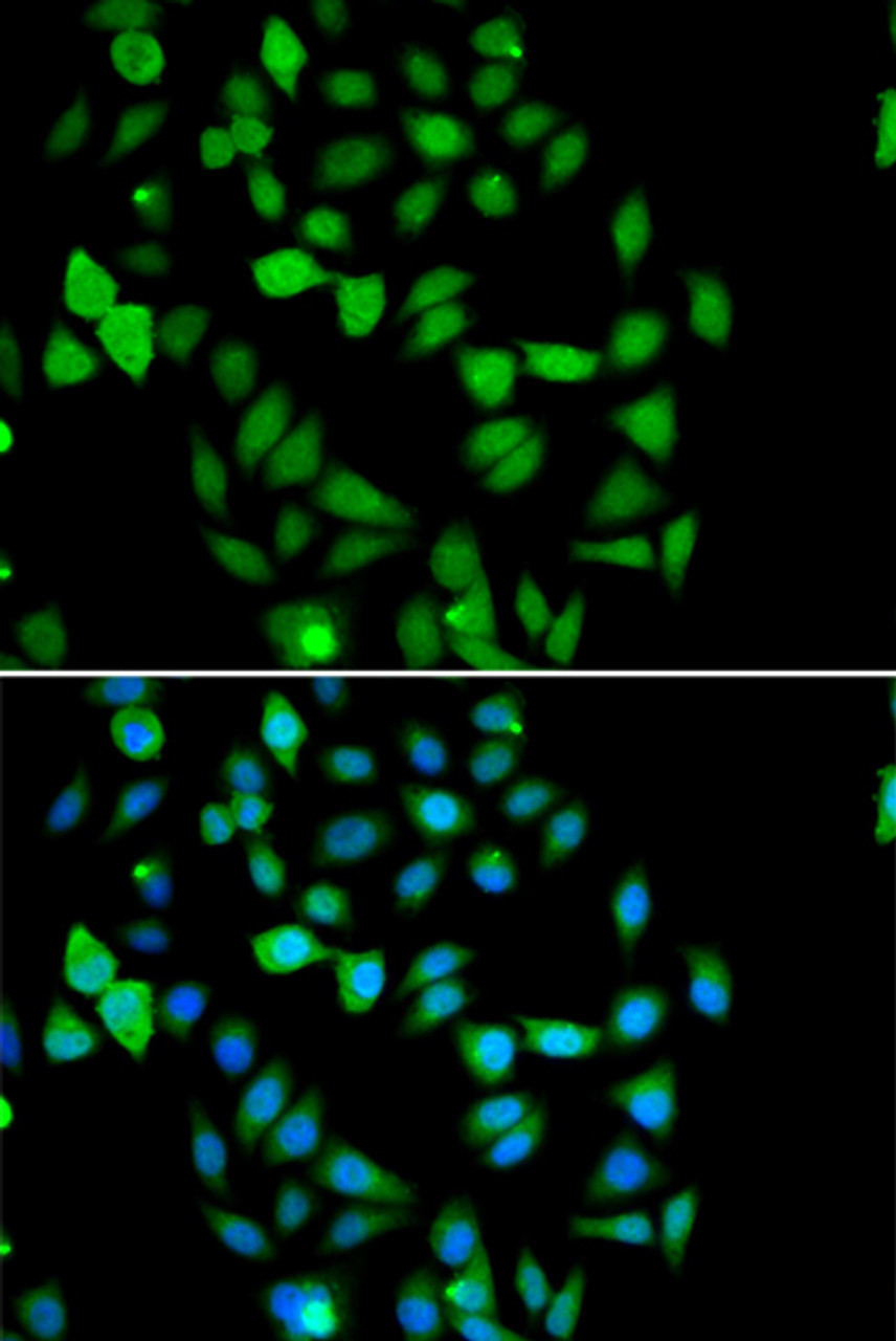 Immunofluorescence analysis of U2OS cells using STAMBP Polyclonal Antibody