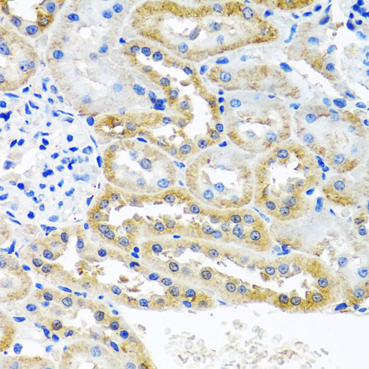 Immunohistochemistry of paraffin-embedded Rat kidney using OGFR Polyclonal Antibody at dilution of  1:100 (40x lens).