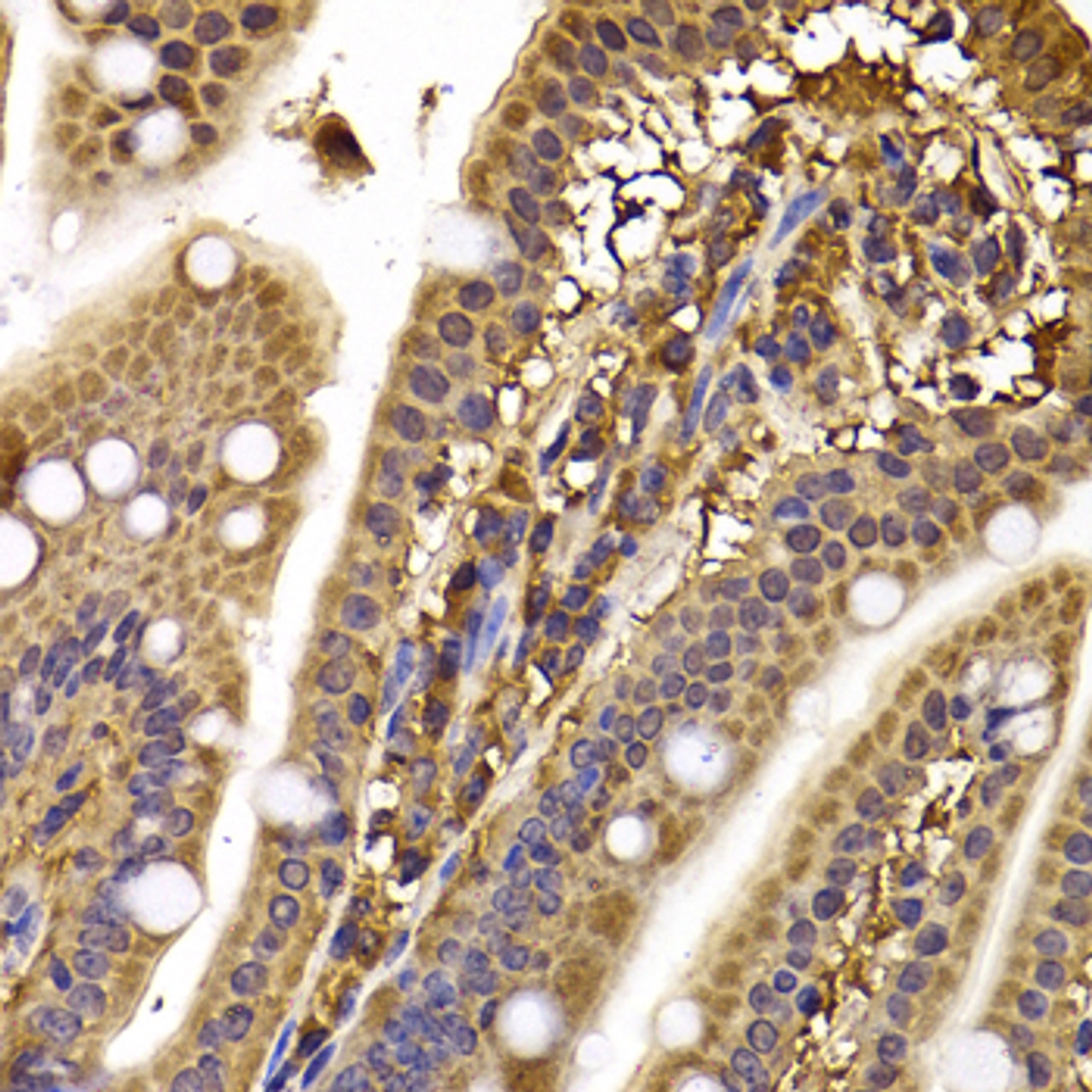 Immunohistochemistry of paraffin-embedded Mouse ileum using CLASP1 Polyclonal Antibody at dilution of  1:100 (40x lens).