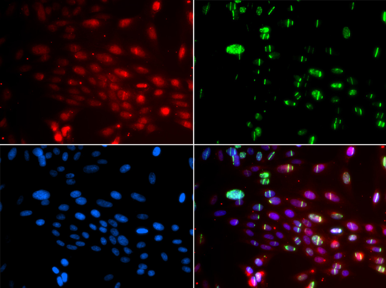 Immunofluorescence analysis of GFP-RNF168 transgenic U2OS cells using L3MBTL1 Polyclonal Antibody