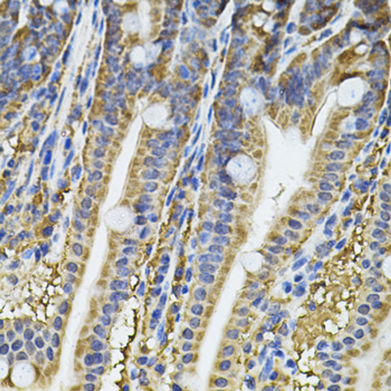 Immunohistochemistry of paraffin-embedded Mouse intestine using NFU1 Polyclonal Antibody at dilution of  1:100 (40x lens).