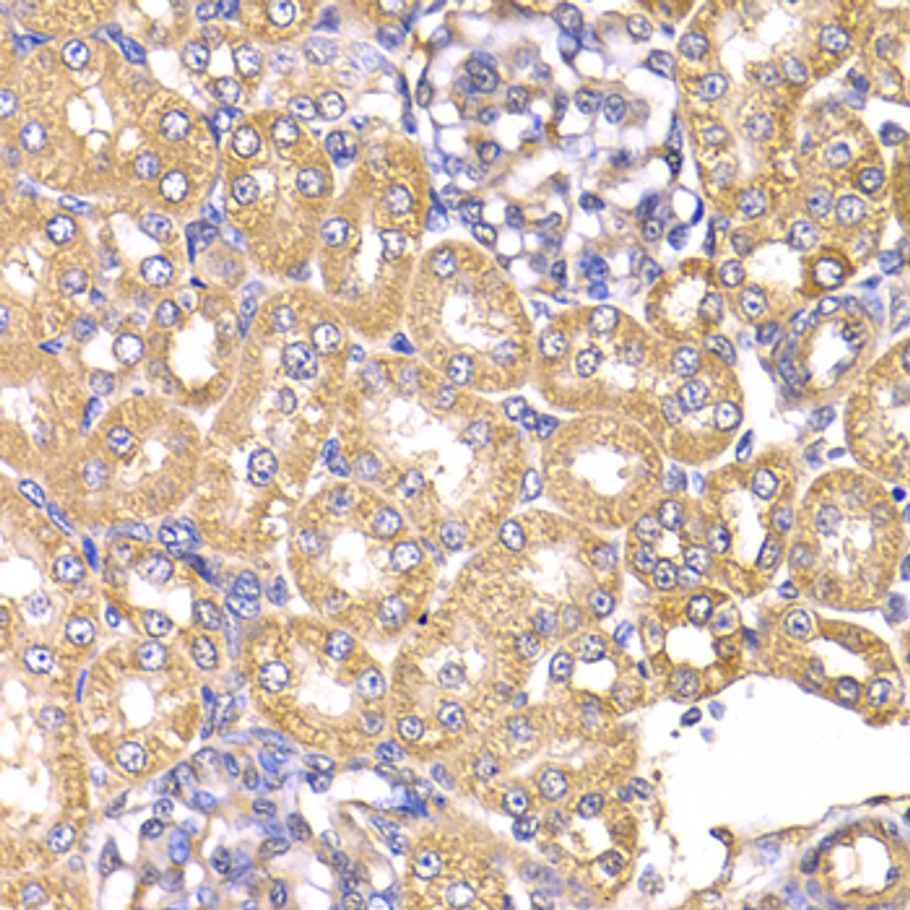 Immunohistochemistry of paraffin-embedded Rat kidney using LAP3 Polyclonal Antibody at dilution of  1:100 (40x lens).