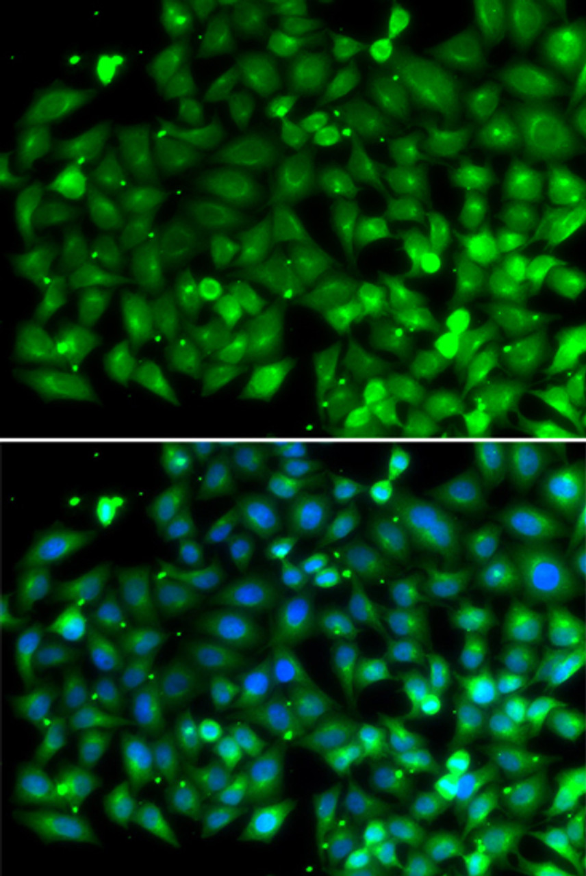 Immunofluorescence analysis of A549 cells using SH3GLB1 Polyclonal Antibody