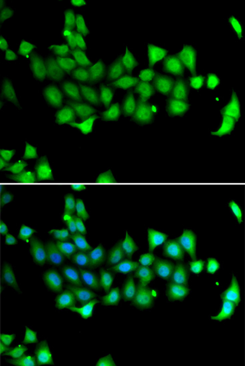 Immunofluorescence analysis of A549 cells using HSPA14 Polyclonal Antibody