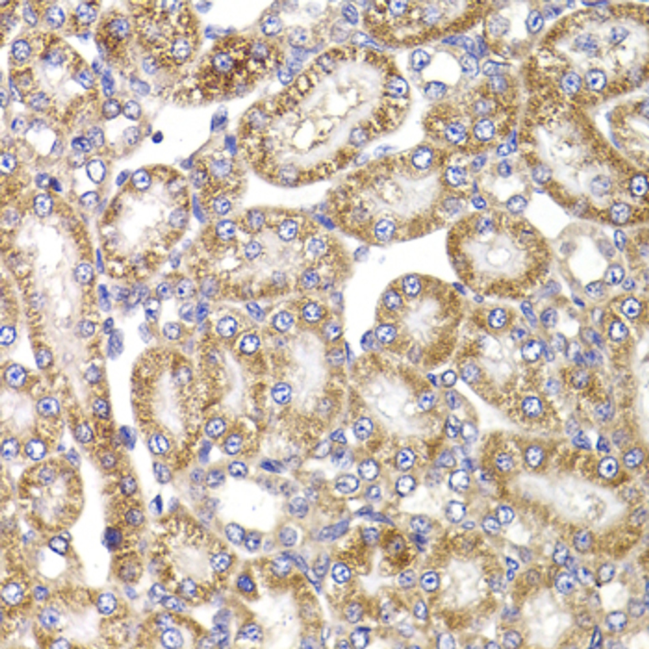 Immunohistochemistry of paraffin-embedded Rat kidney using ANAPC5 Polyclonal Antibody at dilution of  1:100 (40x lens).