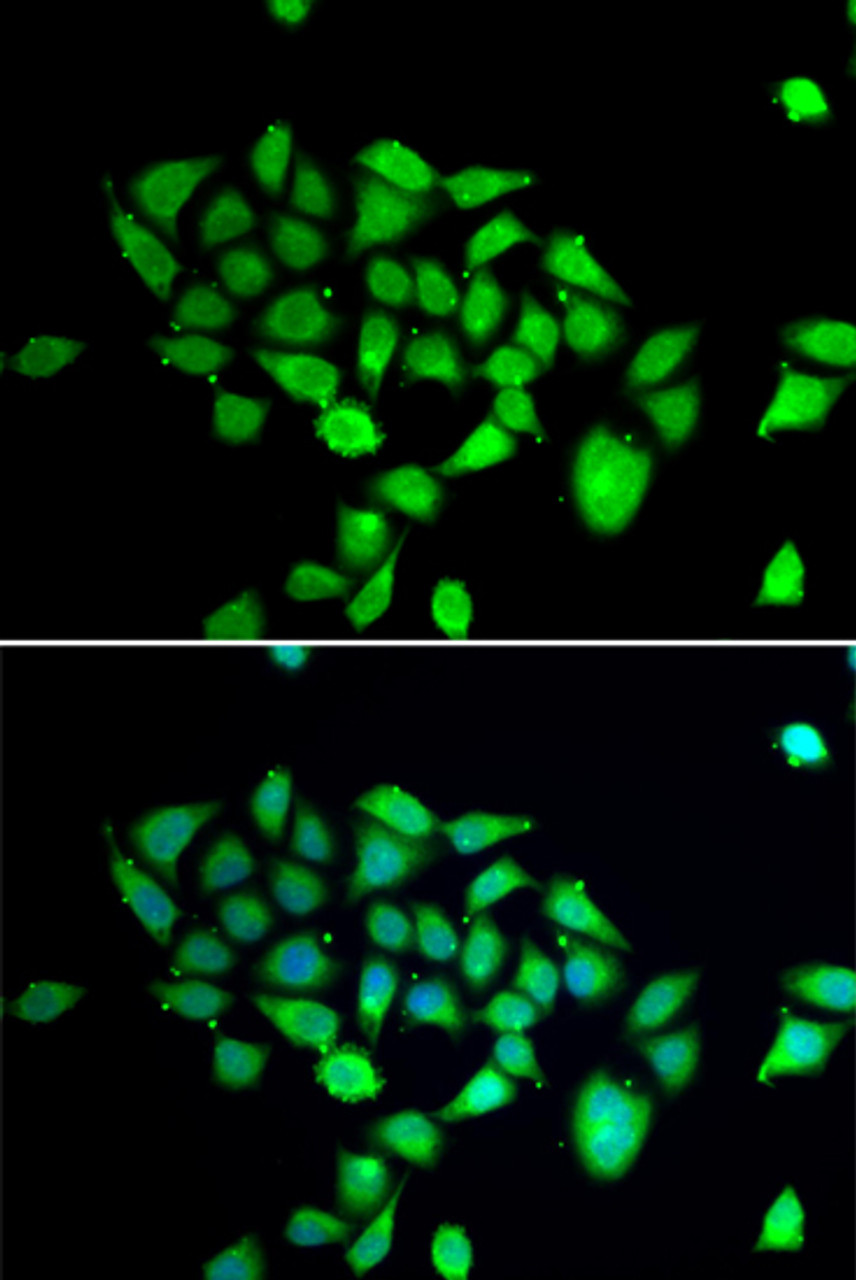Immunofluorescence analysis of A549 cells using DPP8 Polyclonal Antibody