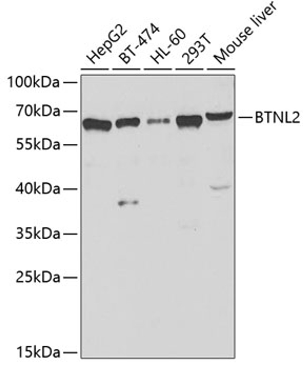 Western blot analysis of extracts of various cell lines using BTNL2 Polyclonal Antibody at dilution of 1:1000.