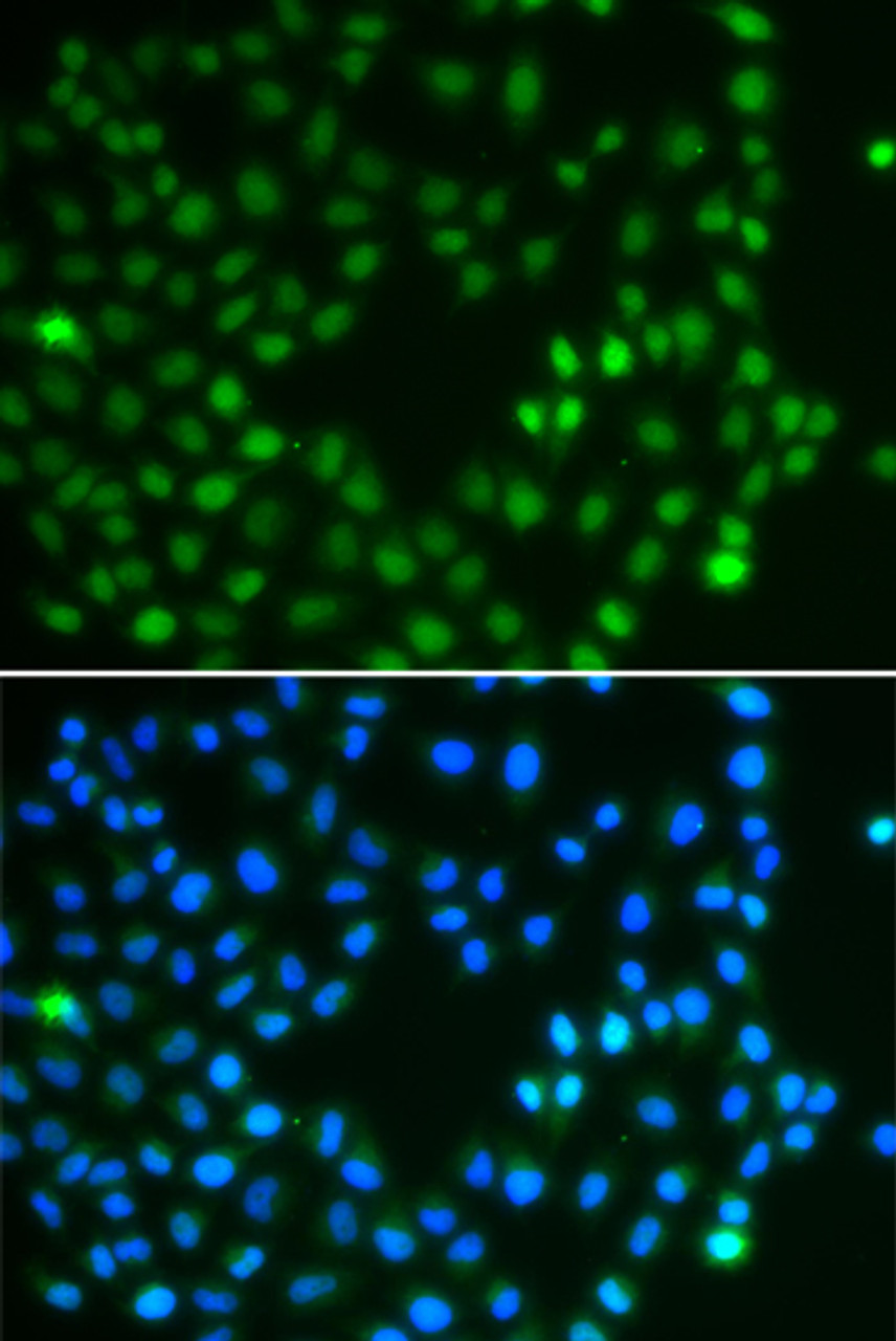 Immunofluorescence analysis of A549 cells using SALL4 Polyclonal Antibody