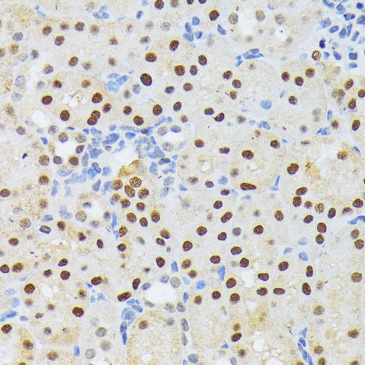Immunohistochemistry of paraffin-embedded Mouse kidney using ELAC2 Polyclonal Antibody at dilution of  1:200 (40x lens).