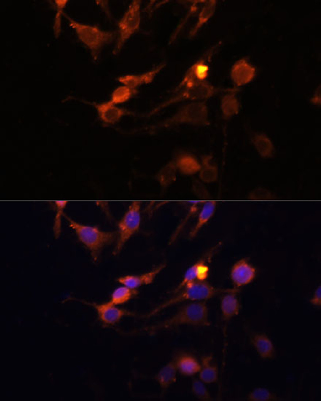 Immunofluorescence analysis of C6 cells using PINK1 Polyclonal Antibody at dilution of  1:100 (40x lens). Blue: DAPI for nuclear staining.
