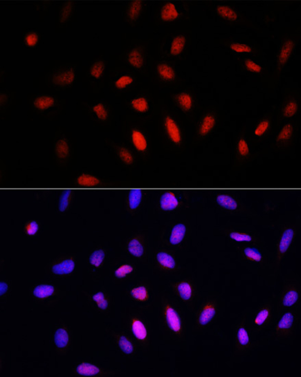Immunofluorescence analysis of U2OS cells using COMMD1 Polyclonal Antibody at dilution of  1:100. Blue: DAPI for nuclear staining.