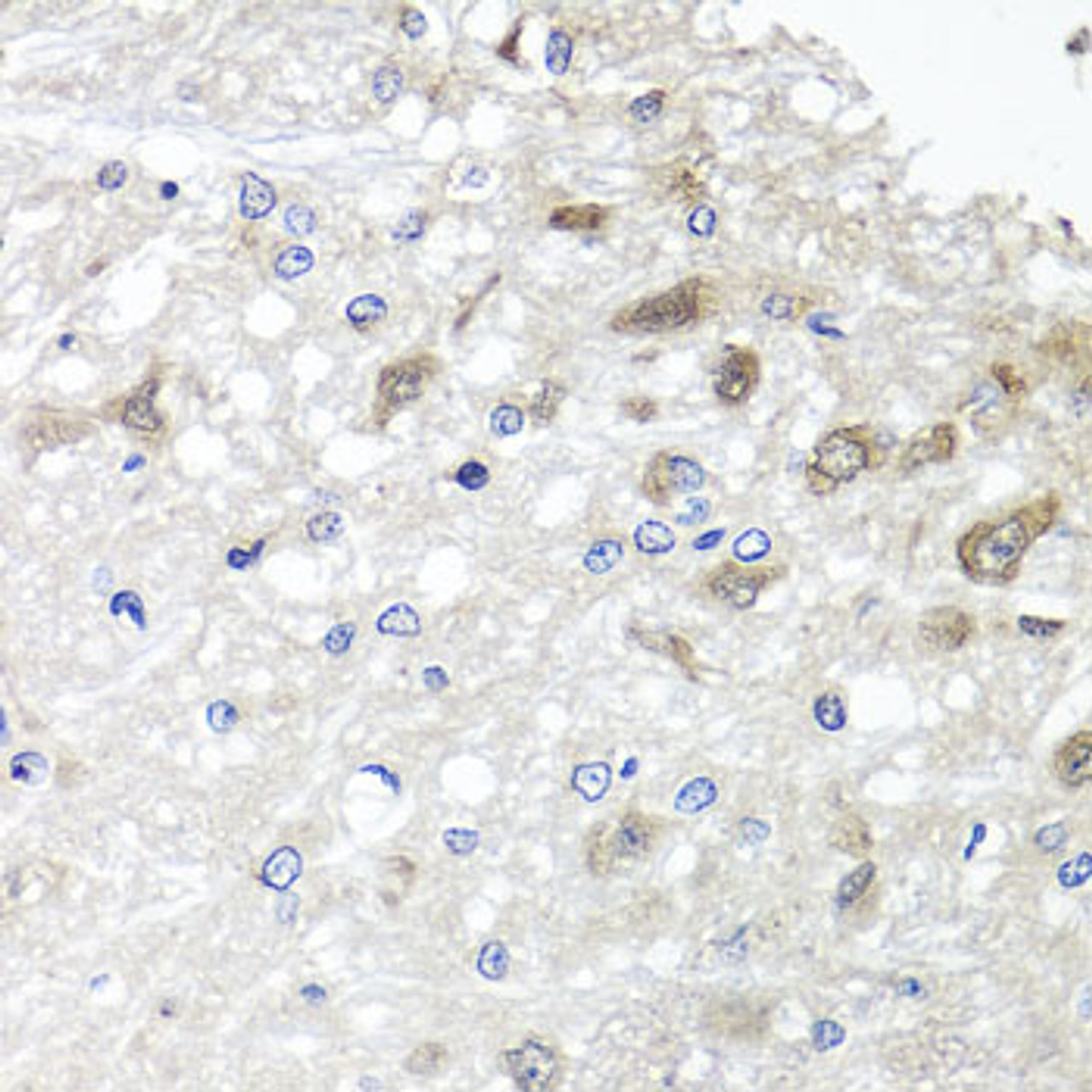 Immunohistochemistry of paraffin-embedded Rat brain using METTL20 Polyclonal Antibody at dilution of  1:100 (40x lens).