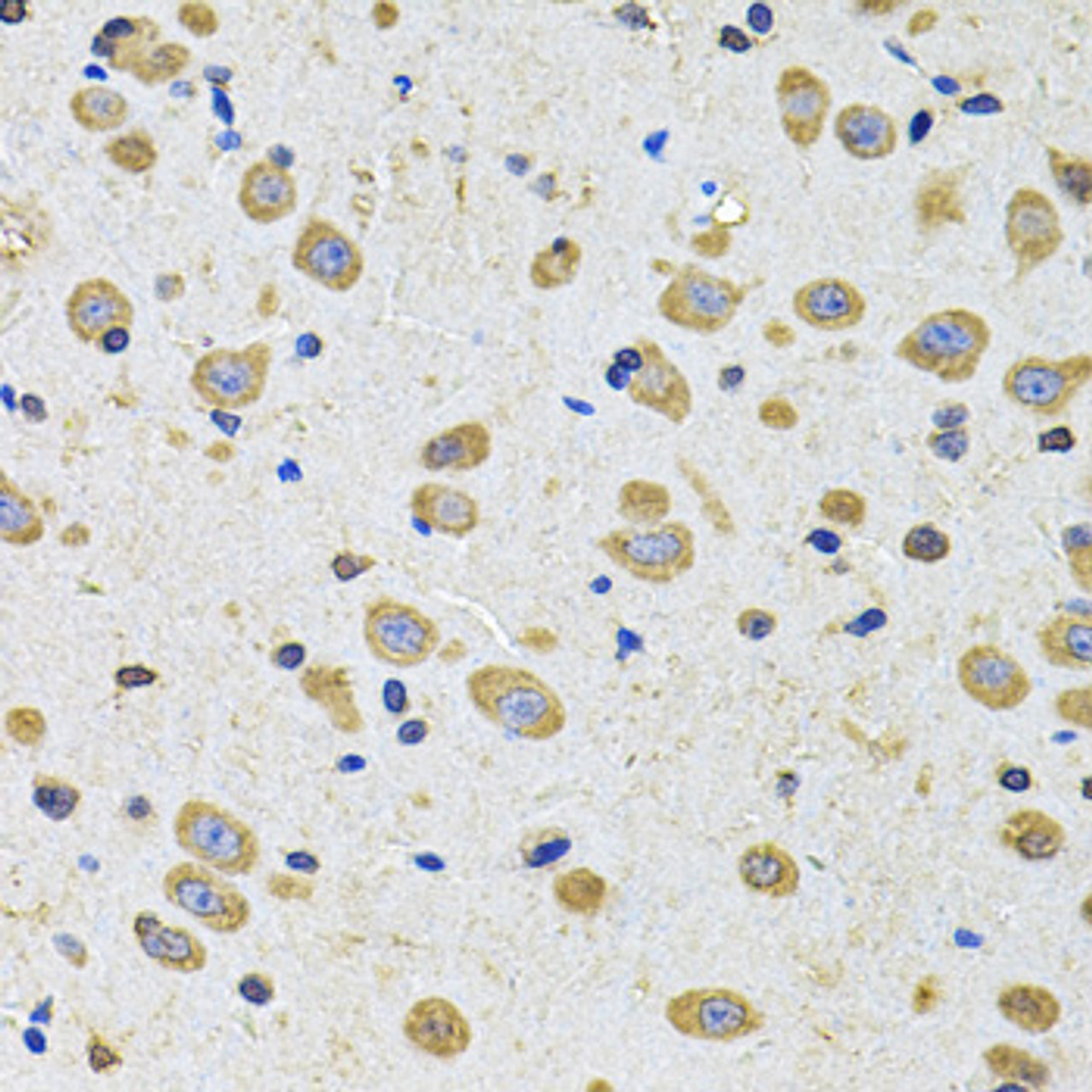 Immunohistochemistry of paraffin-embedded Rat brain using EPHA2 Polyclonal Antibody at dilution of  1:100 (40x lens).