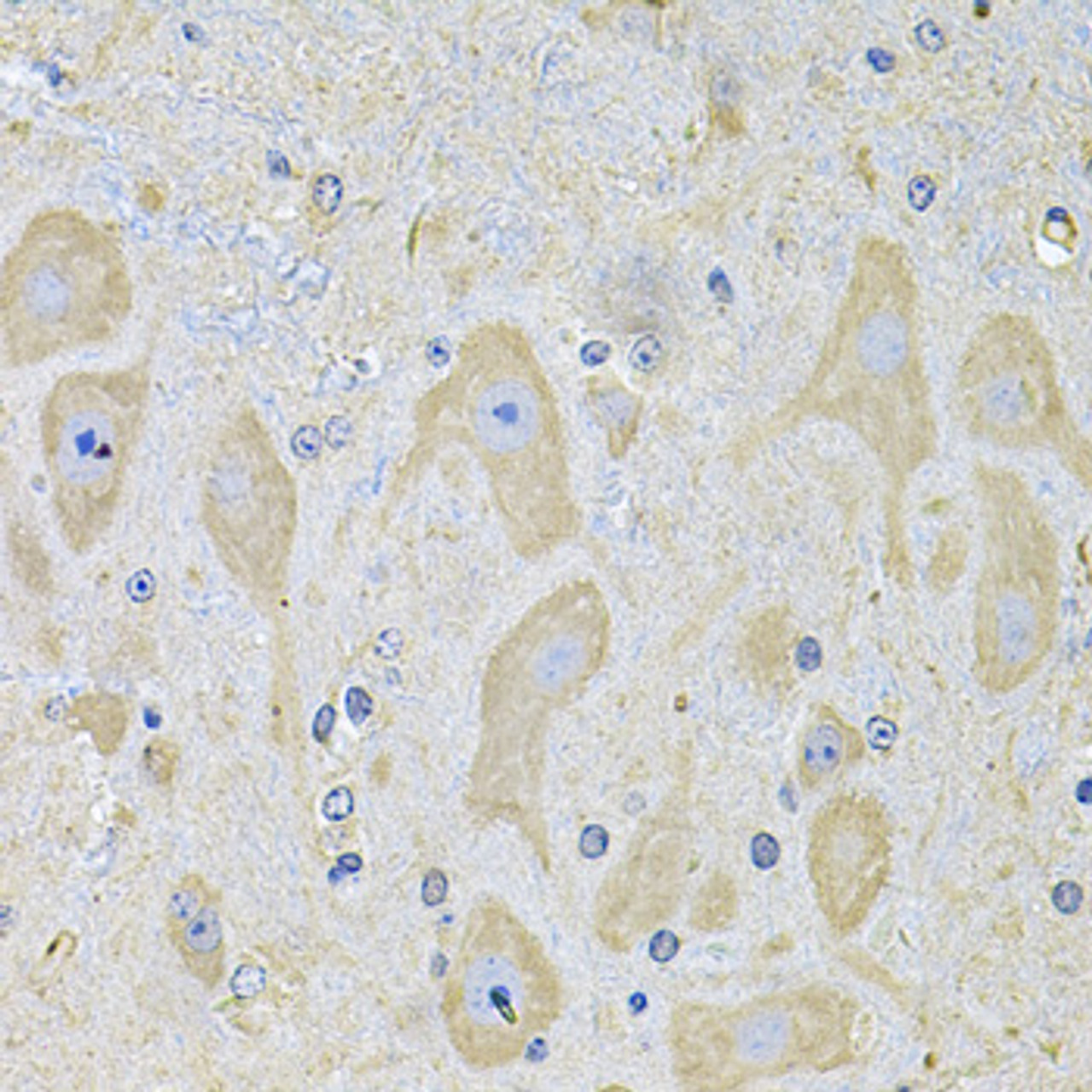 Immunohistochemistry of paraffin-embedded Mouse brain using EPHA2 Polyclonal Antibody at dilution of  1:100 (40x lens).