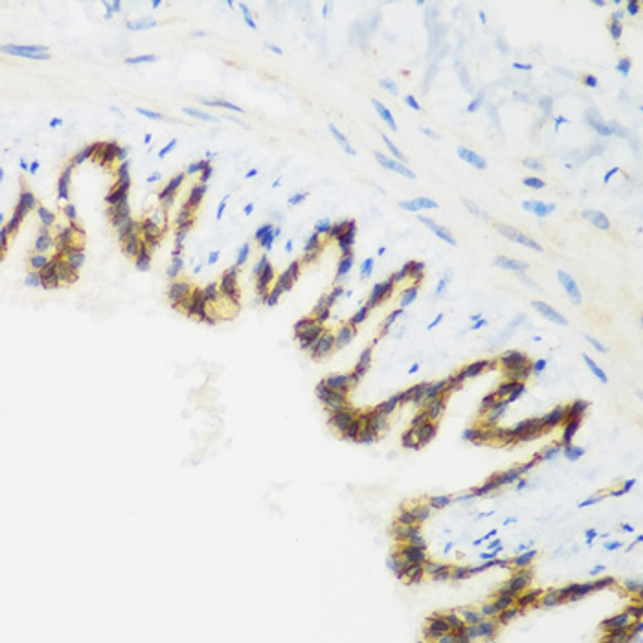 Immunohistochemistry of paraffin-embedded Rat lung using KIAA1456 Polyclonal Antibody at dilution of  1:200 (40x lens).