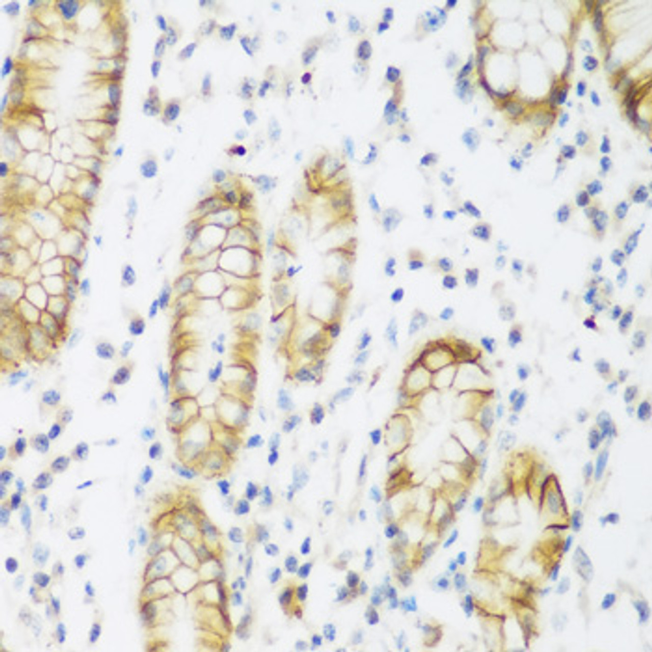 Immunohistochemistry of paraffin-embedded Human stomach using KIAA1456 Polyclonal Antibody at dilution of  1:200 (40x lens).