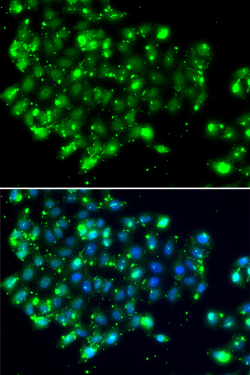 Immunofluorescence analysis of MCF-7 cells using NAT9 Polyclonal Antibody