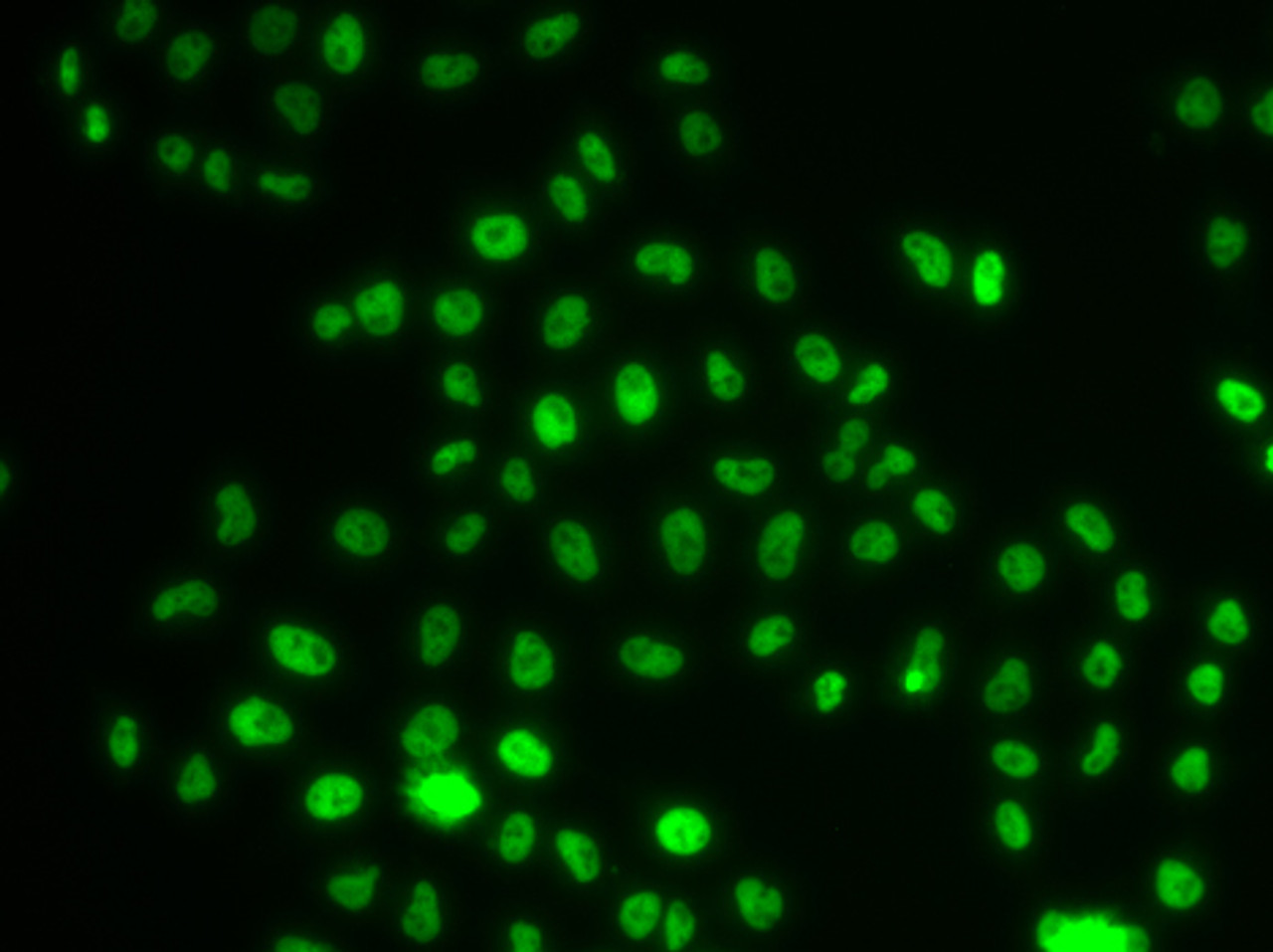 Immunofluorescence analysis of MCF-7 cells using PHIP Polyclonal Antibody