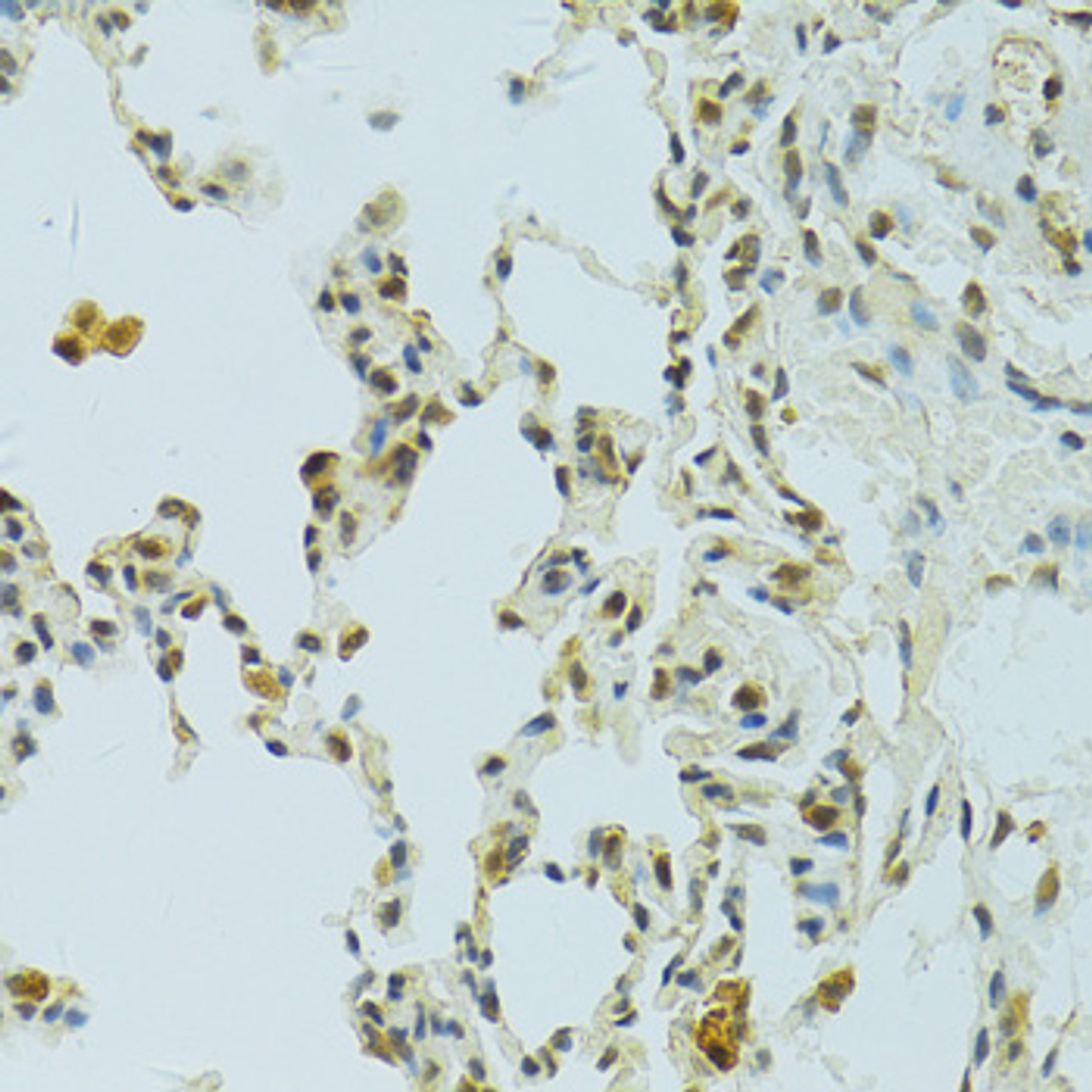 Immunohistochemistry of paraffin-embedded Rat lung using RSRC1 Polyclonal Antibody at dilution of  1:100 (40x lens).
