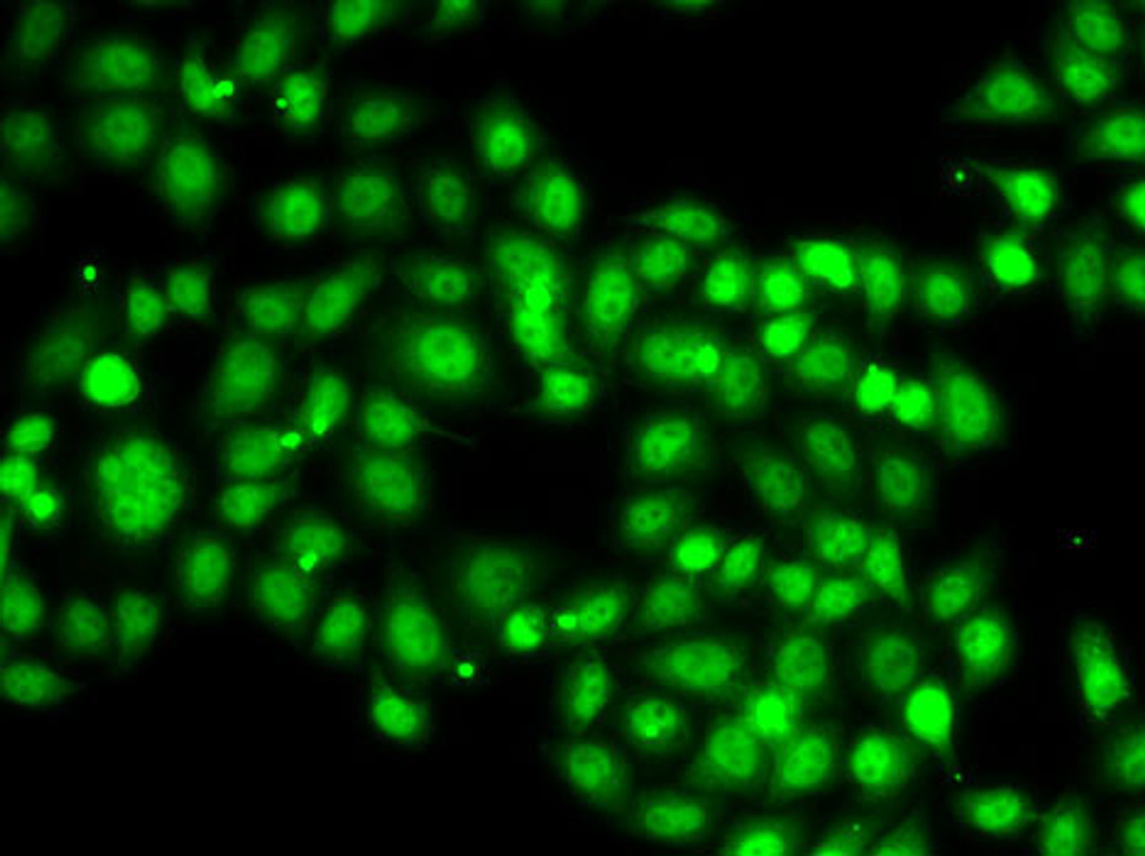 Immunofluorescence analysis of A-549 cells using SETBP1 Polyclonal Antibody