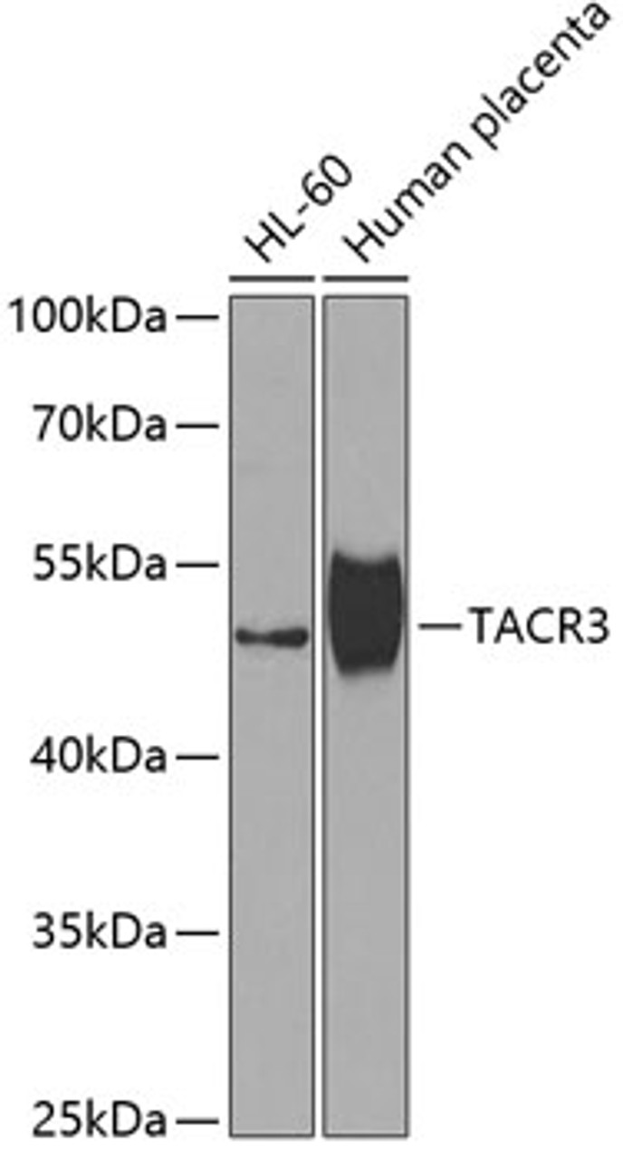 Western blot analysis of extracts of various cell lines using TACR3 Polyclonal Antibody at dilution of 1:1000.