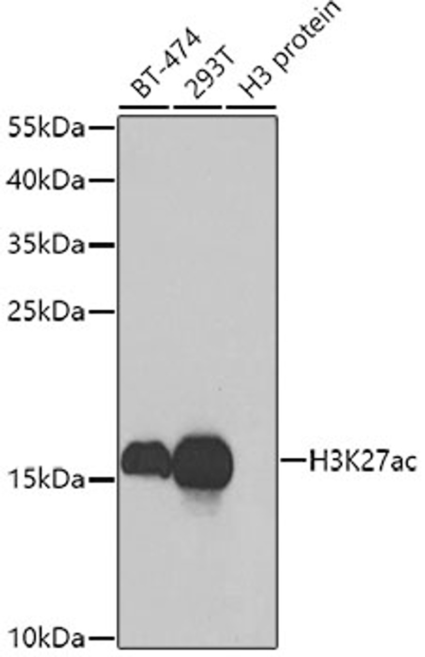 Western blot analysis of extracts of various cell lines using Acetyl-Histone H3-K27 Polyclonal Antibody at dilution of 1:1000.
