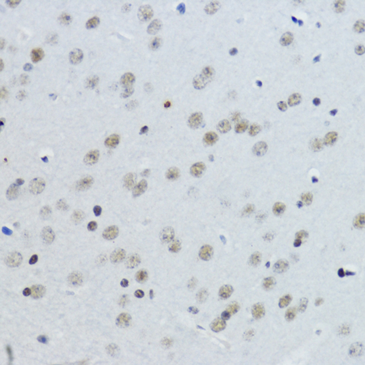 Immunohistochemistry of paraffin-embedded Mouse brain using Acetyl-Histone H3-K27 Polyclonal Antibody at dilution of  1:200 (40x lens).