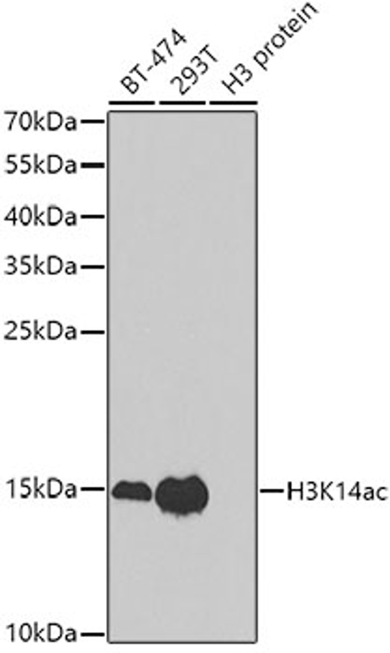 Western blot analysis of extracts of various cell lines using Acetyl-Histone H3-K14 Polyclonal Antibody at dilution of 1:1000.