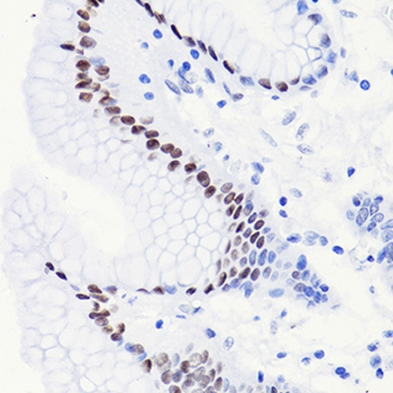 Immunohistochemistry of paraffin-embedded Human stomach using Acetyl-Histone H3-K14 Polyclonal Antibody at dilution of  1:100 (40x lens).