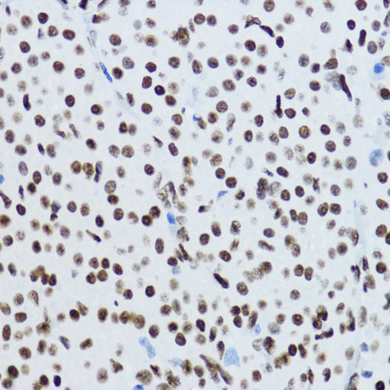 Immunohistochemistry of paraffin-embedded Rat ovary using Acetyl-Histone H3-K9 Polyclonal Antibody at dilution of  1:200 (40x lens).