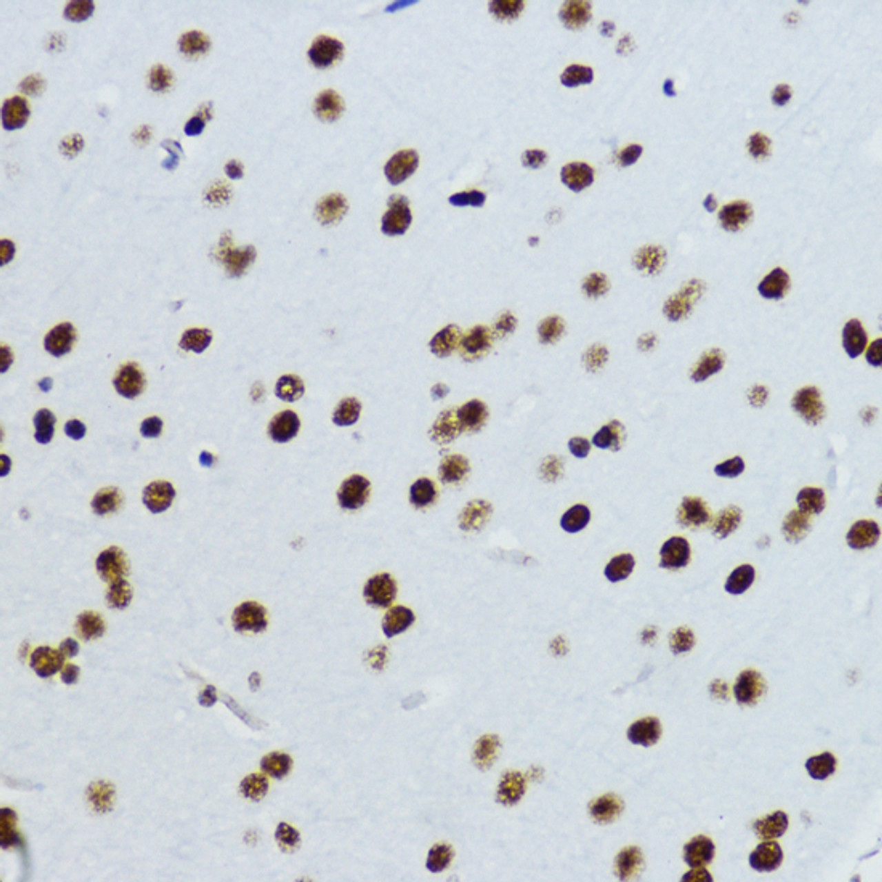 Immunohistochemistry of paraffin-embedded Mouse brain using Acetyl-Histone H3-K9 Polyclonal Antibody at dilution of  1:200 (40x lens).