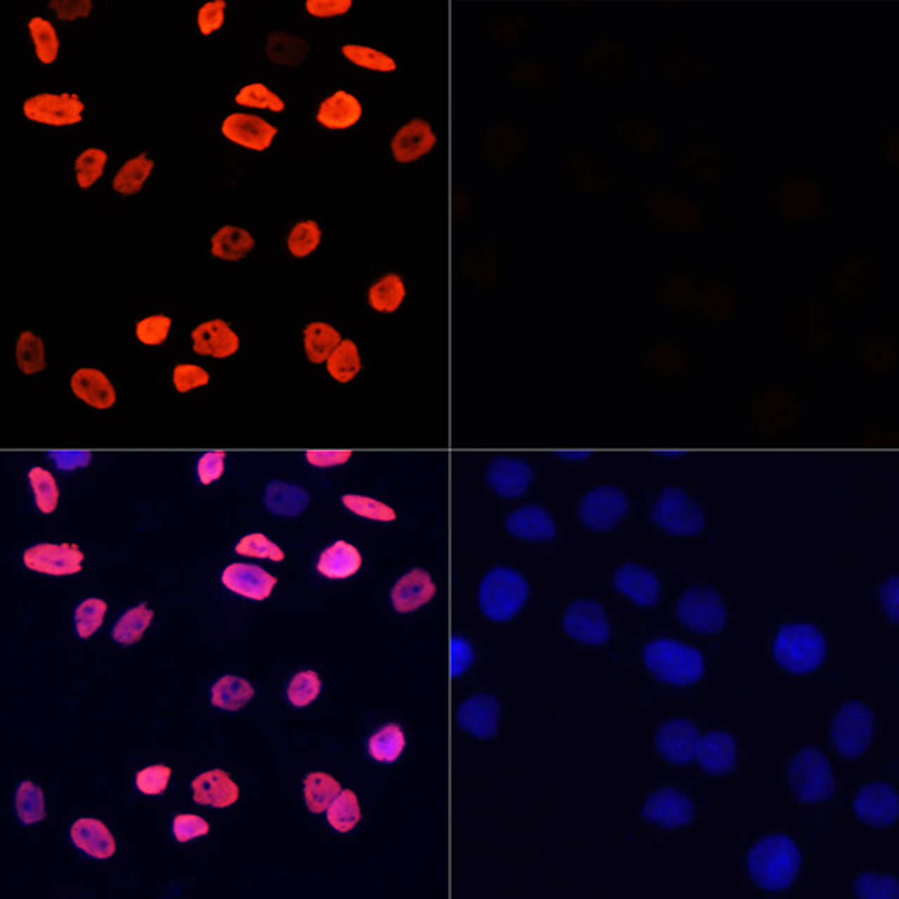 Immunofluorescence analysis of HeLa cells using Acetyl-Histone H3-K9 Polyclonal Antibody at dilution of  1:100 (40x lens). HeLa cells were treated by TSA (1 uM) at 37℃ for 18 hours (left). Blue: DAPI for nuclear staining.