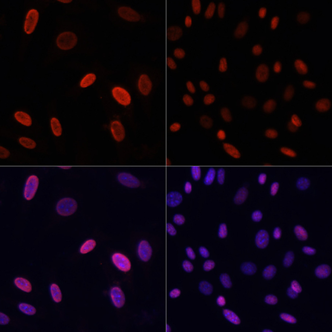 Immunofluorescence analysis of NIH/3T3 cells using Acetyl-Histone H3-K9 Polyclonal Antibody at dilution of  1:100 (40x lens). NIH/3T3 cells were treated by TSA (1 uM) at 37℃ for 18 hours (left). Blue: DAPI for nuclear staining.