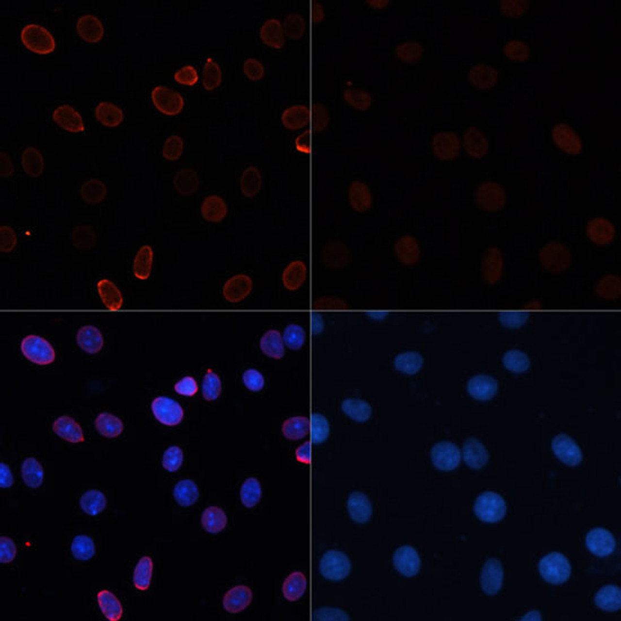 Immunofluorescence analysis of C6 cells using Acetyl-Histone H3-K56 Polyclonal Antibody at dilution of  1:100.C6 cells were treated by TSA (1 uM) at 37℃ for 18 hours (left).Blue: DAPI for nuclear staining.