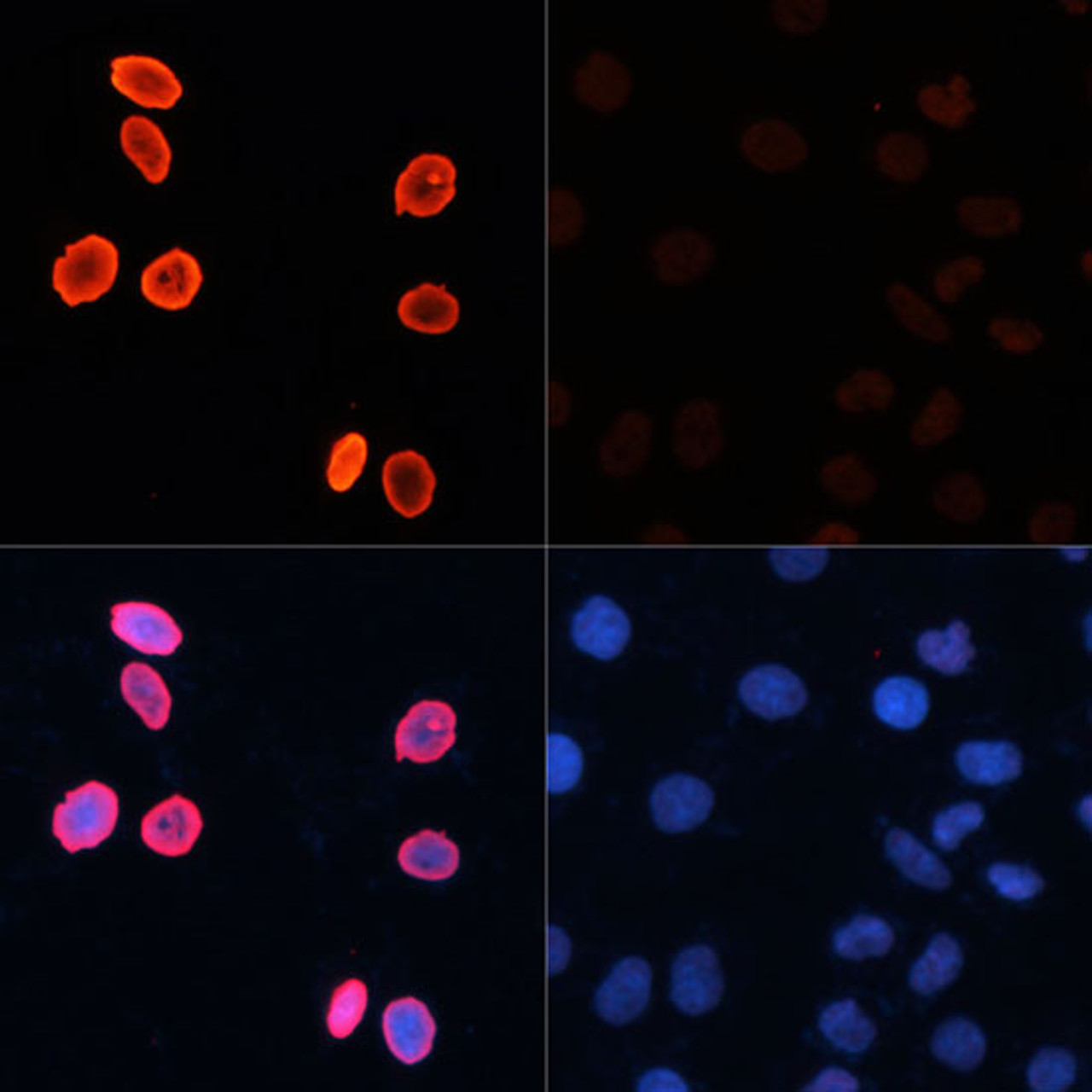Immunofluorescence analysis of HeLa cells using Acetyl-Histone H3-K56 Polyclonal Antibody at dilution of  1:100.HeLa cells were treated by TSA (1 uM) at 37℃ for 18 hours (left).Blue: DAPI for nuclear staining.