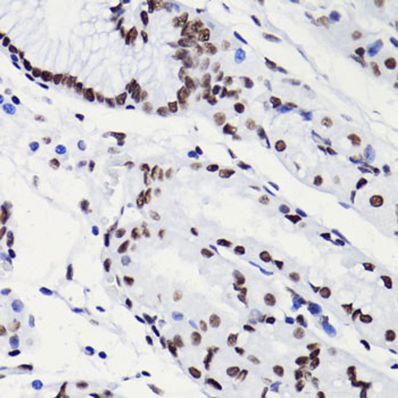 Immunohistochemistry of paraffin-embedded Human stomach using Acetyl-Histone H3-K18 Polyclonal Antibody at dilution of  1:100 (40x lens).