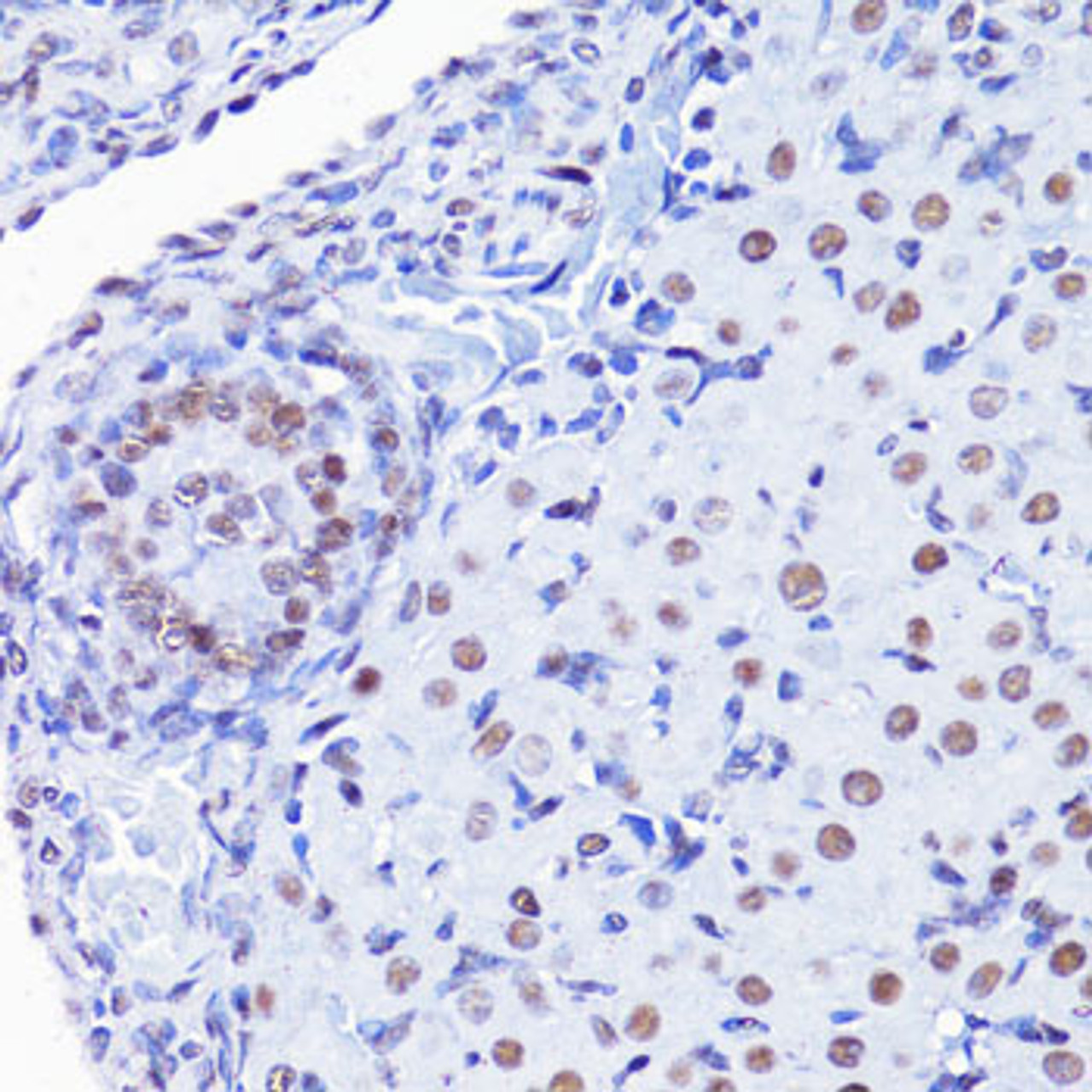 Immunohistochemistry of paraffin-embedded Rat ovary using Acetyl-Histone H4-K8 Polyclonal Antibody at dilution of  1:100 (40x lens).