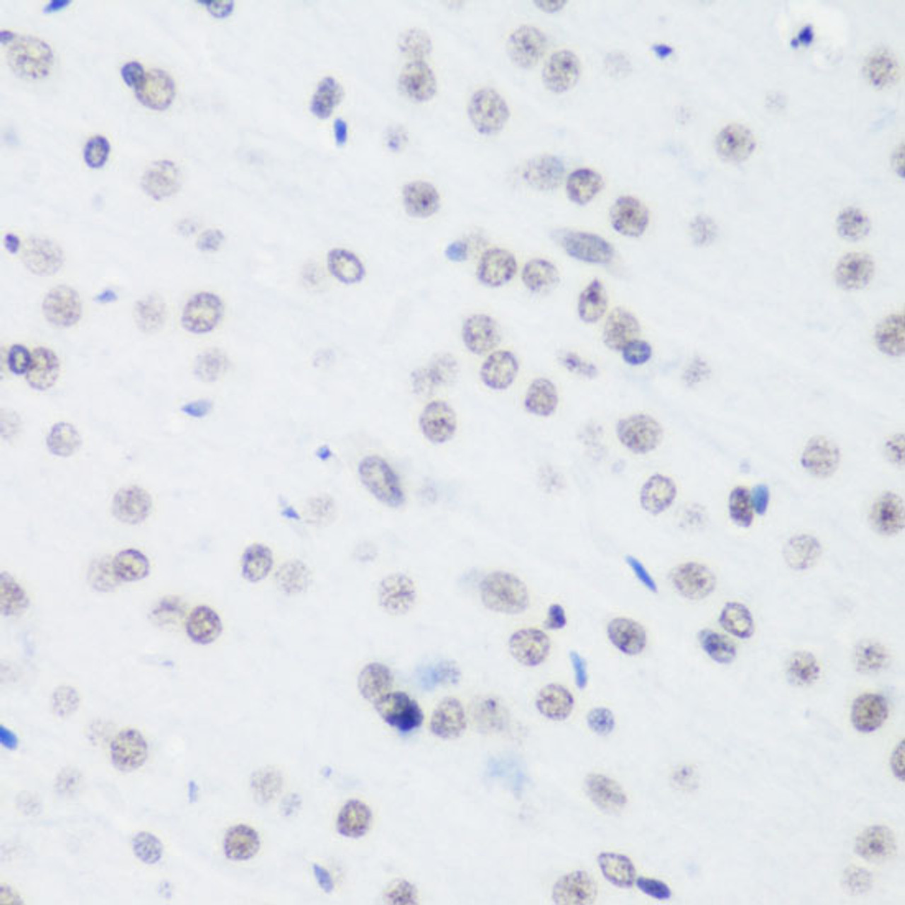 Immunohistochemistry of paraffin-embedded Rat brain using TriMethyl-Histone H3-K64 Polyclonal Antibody at dilution of  1:100 (40x lens).