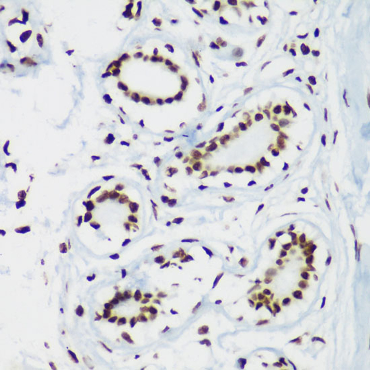 Immunohistochemistry of paraffin-embedded Human breast using TriMethyl-Histone H3-K64 Polyclonal Antibody at dilution of  1:100 (40x lens).