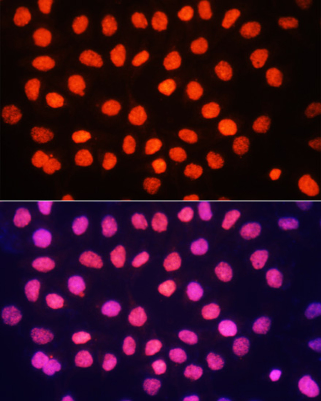 Immunofluorescence analysis of HeLa cells using TriMethyl-Histone H3-K64 Polyclonal Antibody at dilution of  1:100. Blue: DAPI for nuclear staining.