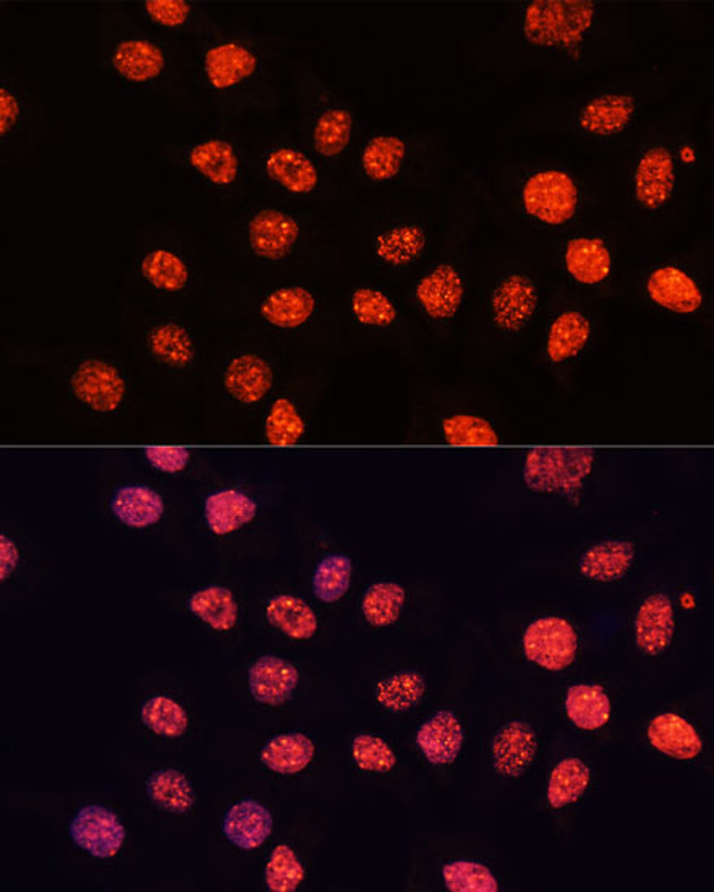 Immunofluorescence analysis of HeLa cells using TriMethyl-Histone H3-K56 Polyclonal Antibody at dilution of  1:100 (40x lens). Blue: DAPI for nuclear staining.