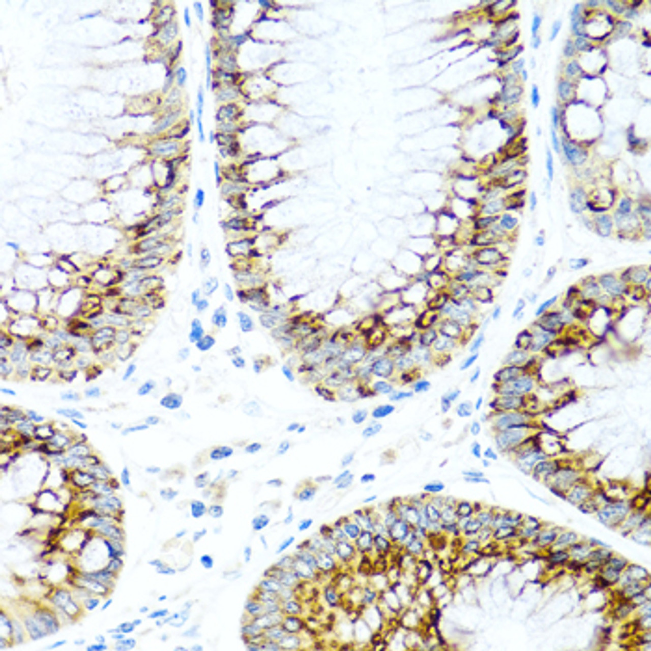 Immunohistochemistry of paraffin-embedded Human colon using MCP-1 Polyclonal Antibody at dilution of  1:100 (40x lens).