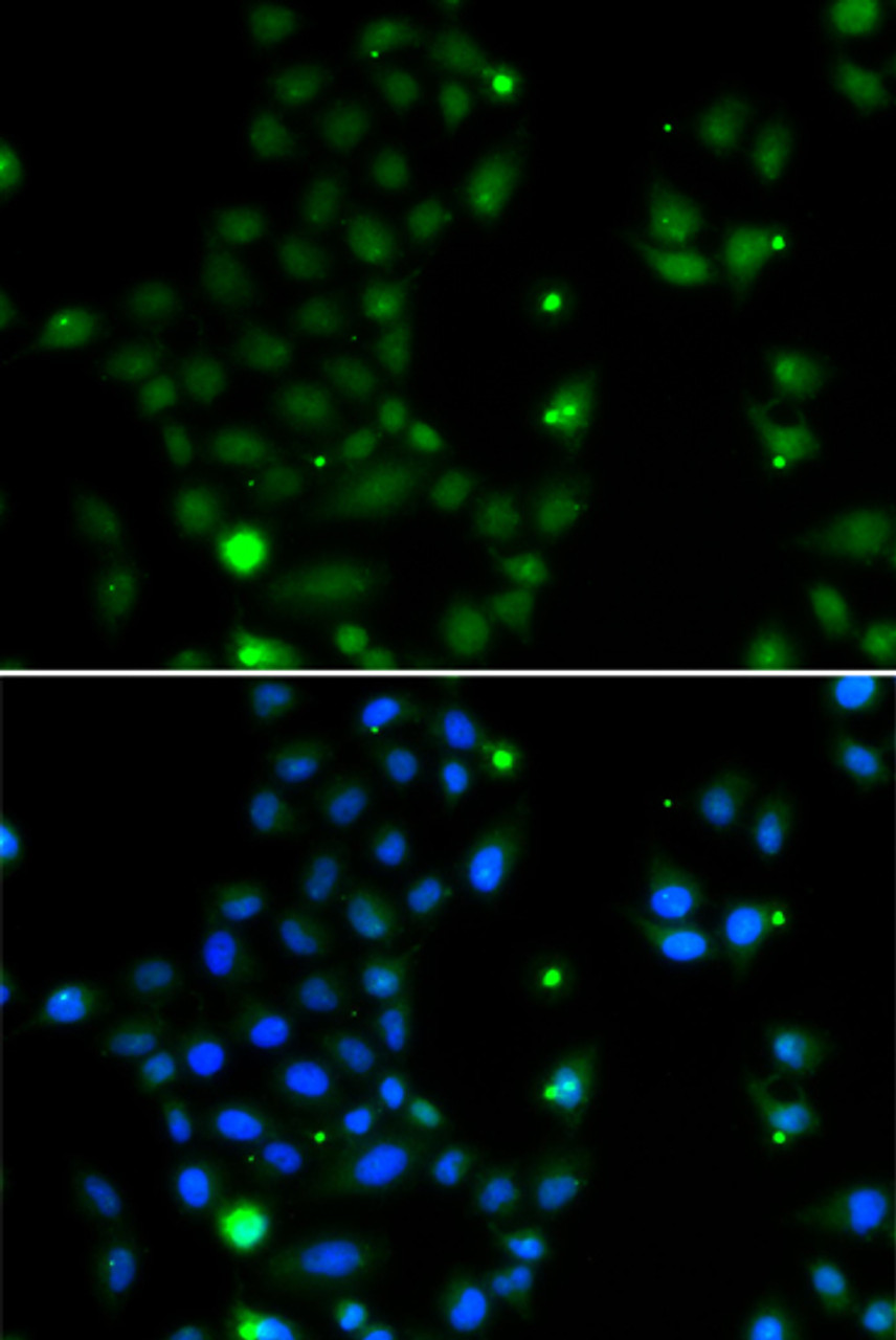Immunofluorescence analysis of MCF-7 cells using GCM1 Polyclonal Antibody