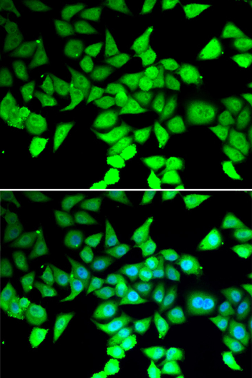 Immunofluorescence analysis of MCF-7 cells using HDAC7 Polyclonal Antibody