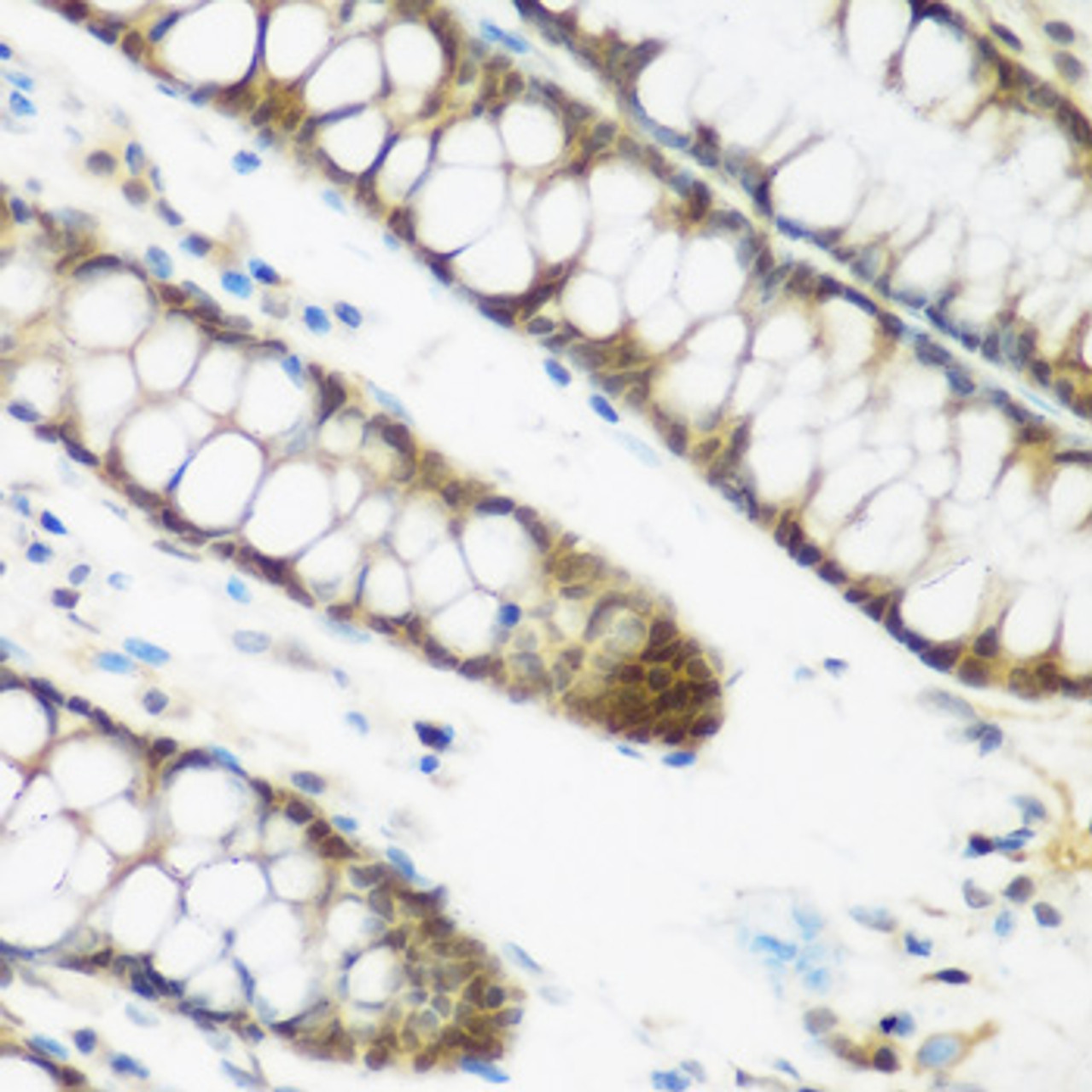 Immunohistochemistry of paraffin-embedded Human colon using NCBP2 Polyclonal Antibody at dilution of  1:200 (40x lens).