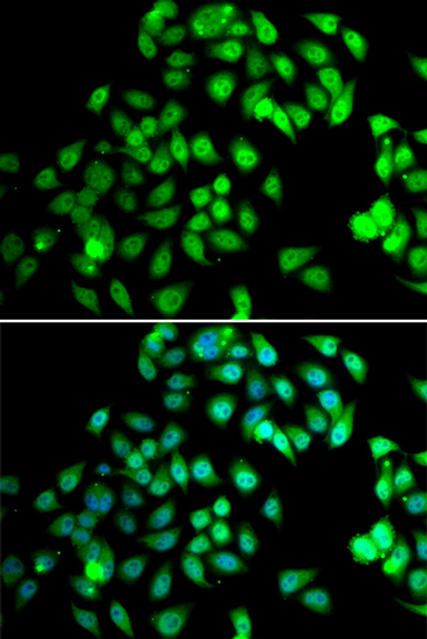 Immunofluorescence analysis of MCF-7 cells using NCBP2 Polyclonal Antibody