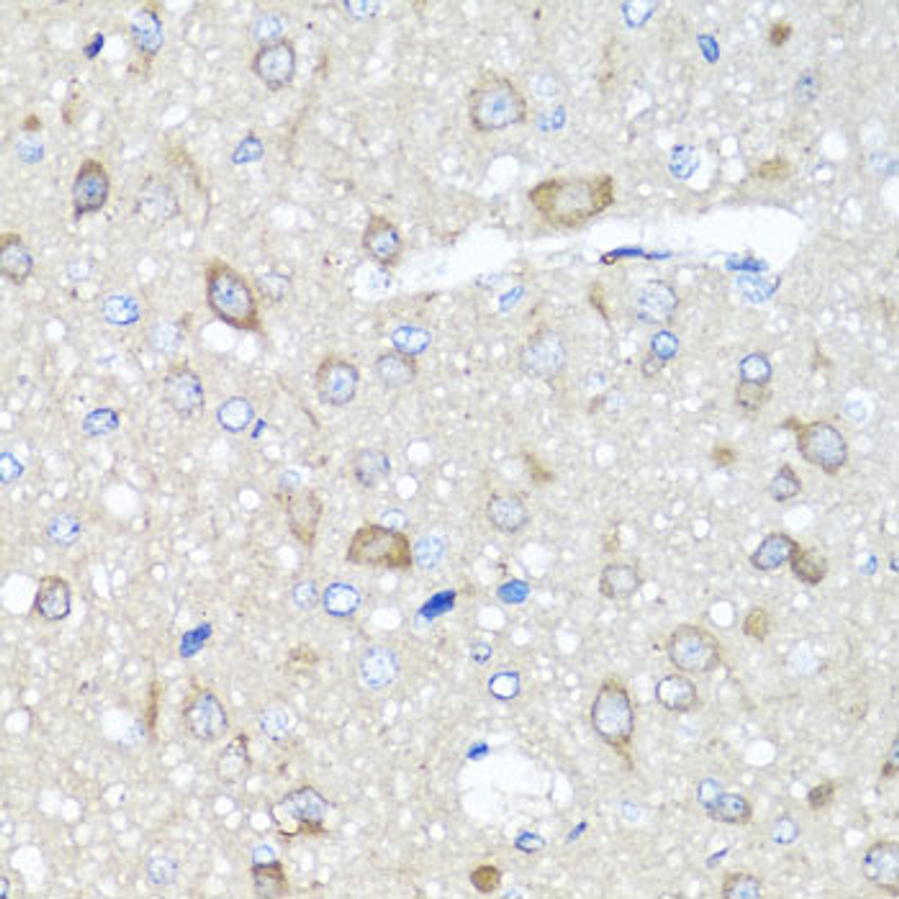 Immunohistochemistry of paraffin-embedded Rat brain using PRKAG1 Polyclonal Antibody at dilution of  1:100 (40x lens).