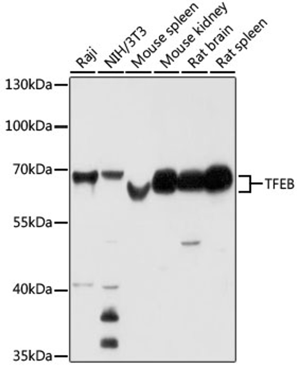 Western blot analysis of extracts of various cell lines using TFEB Polyclonal Antibody at dilution of 1:1000.