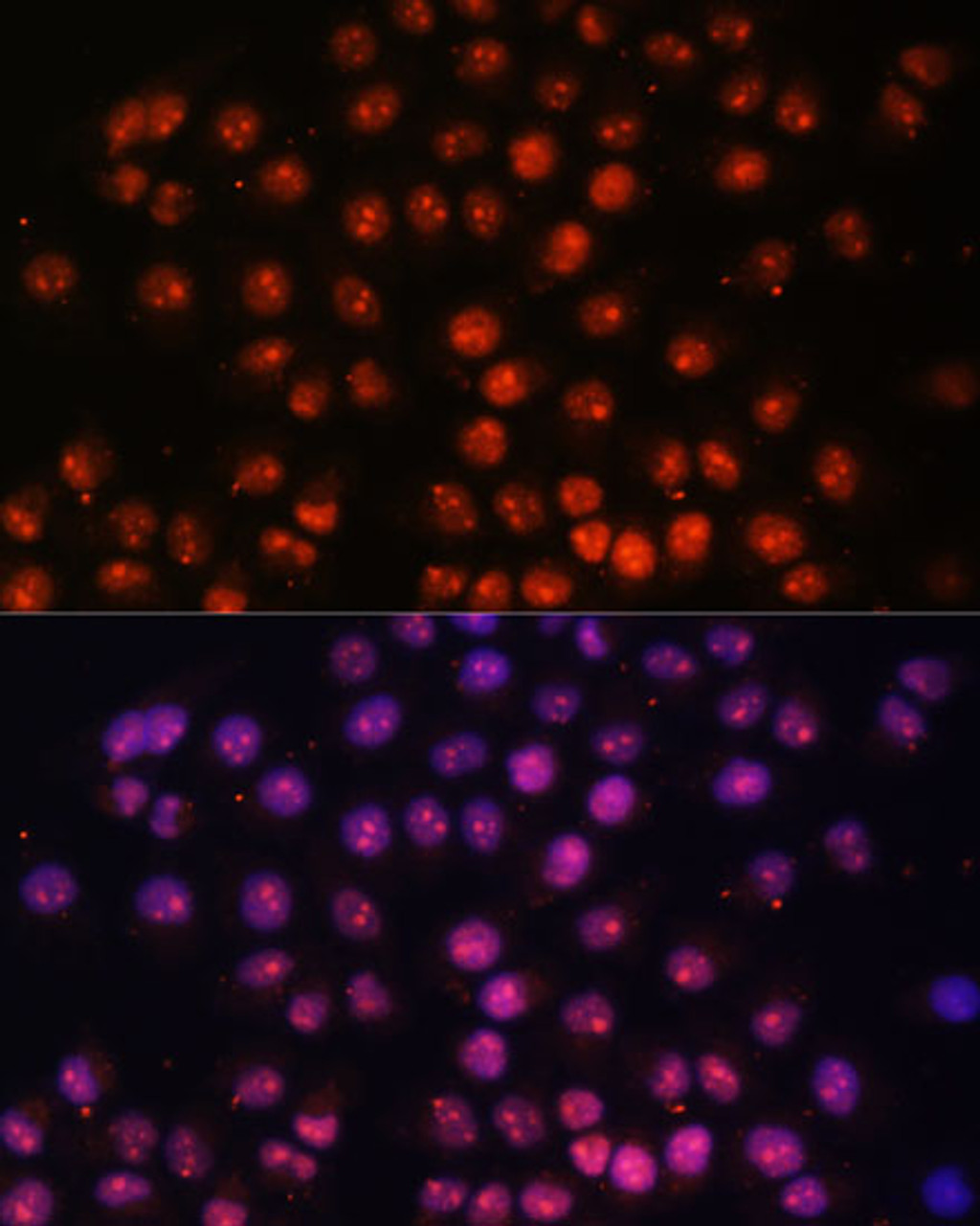 Immunofluorescence analysis of HeLa cells using TFEB Polyclonal Antibody at dilution of  1:100. Blue: DAPI for nuclear staining.