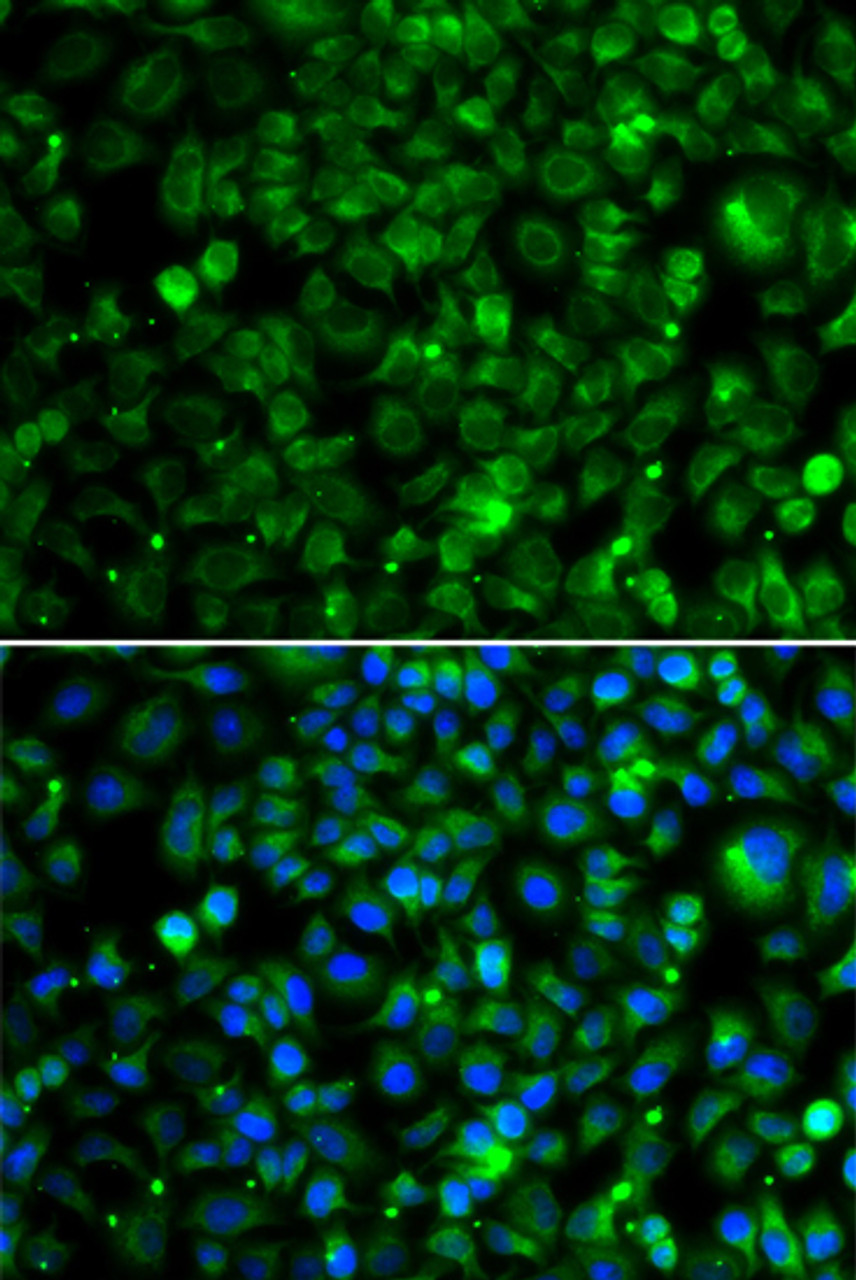 Immunofluorescence analysis of MCF-7 cells using TMLHE Polyclonal Antibody